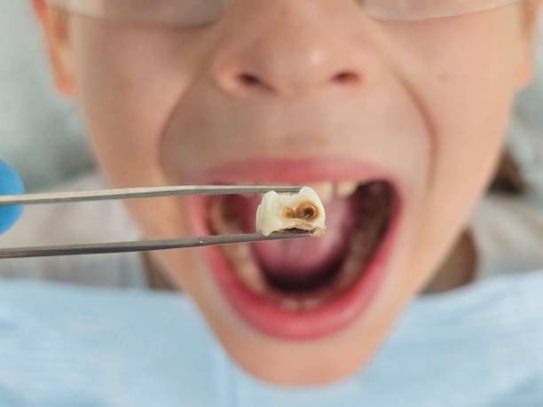 Best Emergency Orthodontic Repairs in Jonesborough, TN